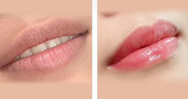 5 cách giảm thâm môi tự nhiên, nhẹ dịu